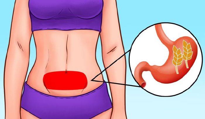 Hasfájás és fogyás: Crohn-betegség lehet az ok